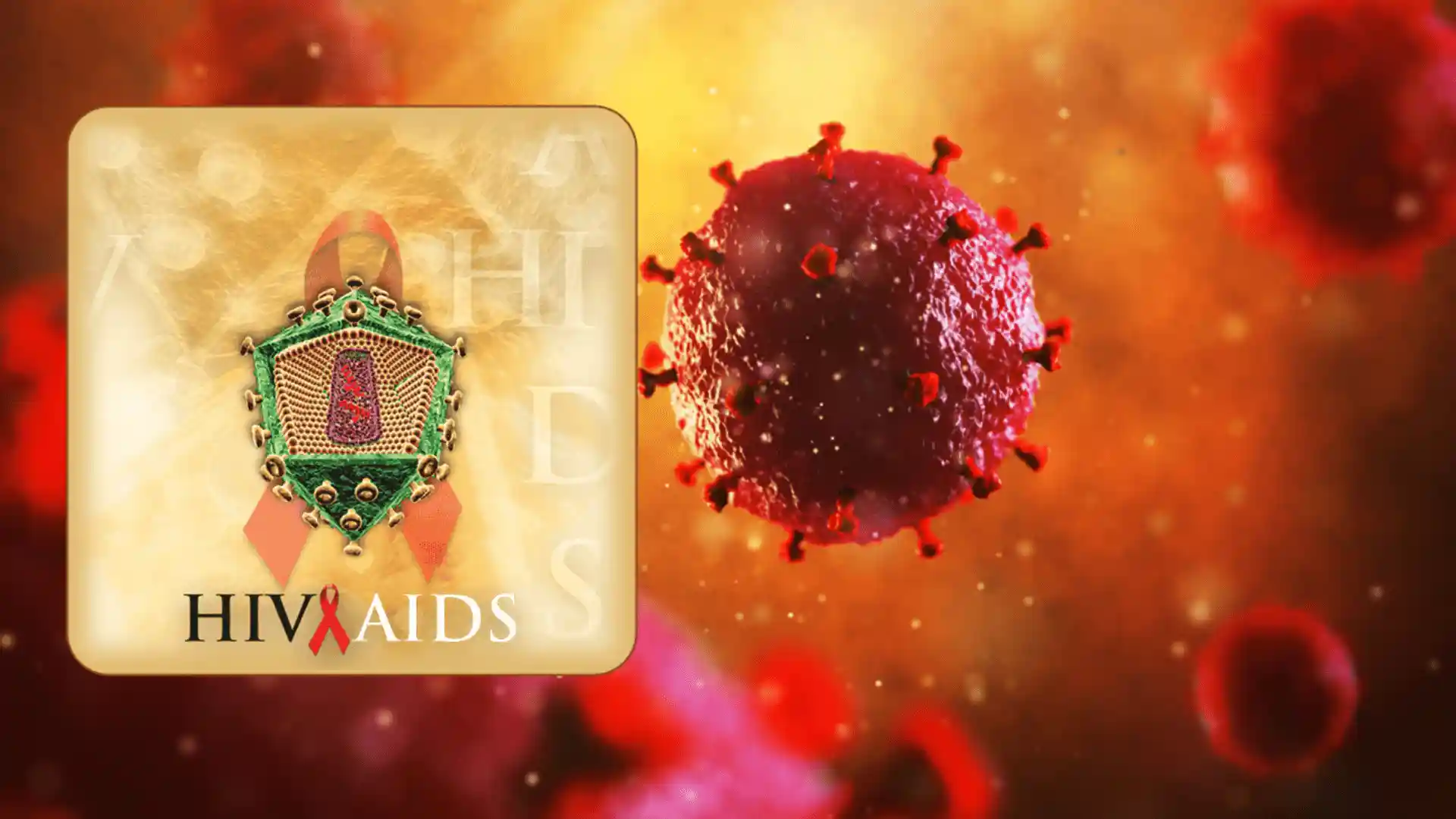 hiv and aids